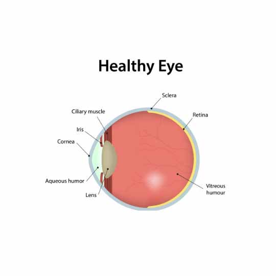 astigmatism